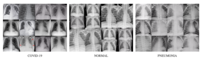A series of x - rays showing different parts of the body.