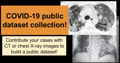 Covid-19 public dataset collection.