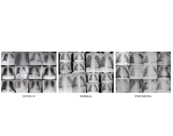 Thoracic x-rays processed using computer vision algorithms to depict various types of abnormalities and diagnoses.