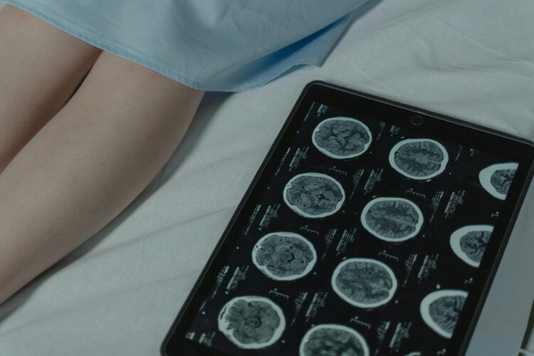 A tablet displaying brain scan images lies on a bed next to a person's legs, partially covered by a hospital gown.